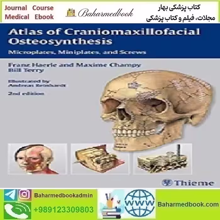 Atlas of Craniomaxillofacial Osteosynthesis Microplates Minipl