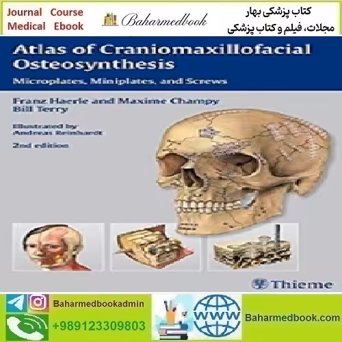 Atlas of Craniomaxillofacial Osteosynthesis Microplates Minipl
