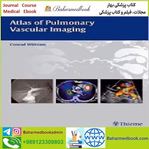 Atlas of Pulmonary Vascular Imaging TRUE PDF price 1€ - کتاب پزشکی بهار