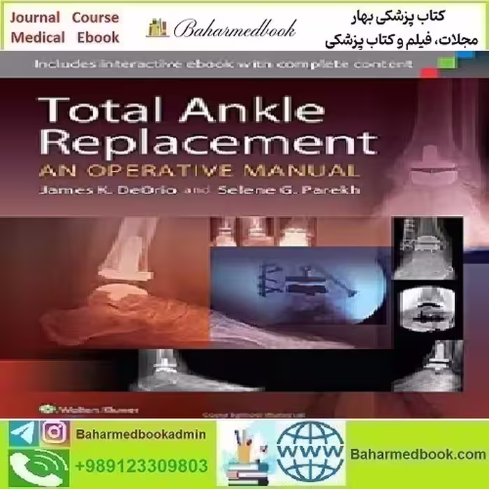 Total Ankle Replacement An Operative Manual 2014