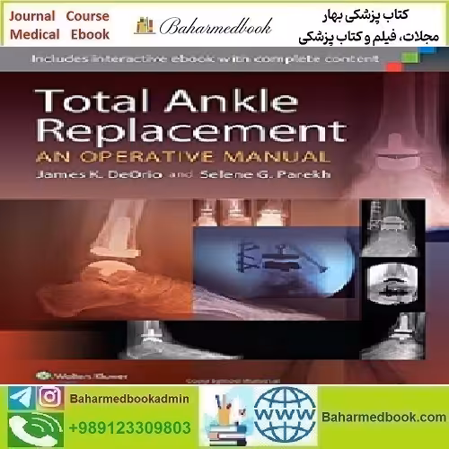 Total Ankle Replacement An Operative Manual 2014