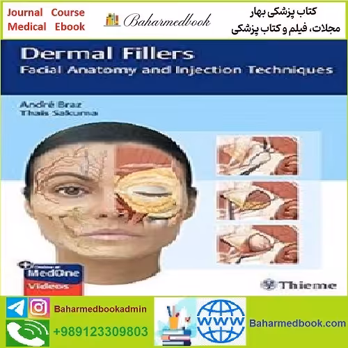 Dermal Fillers TRUE PDF price 1€