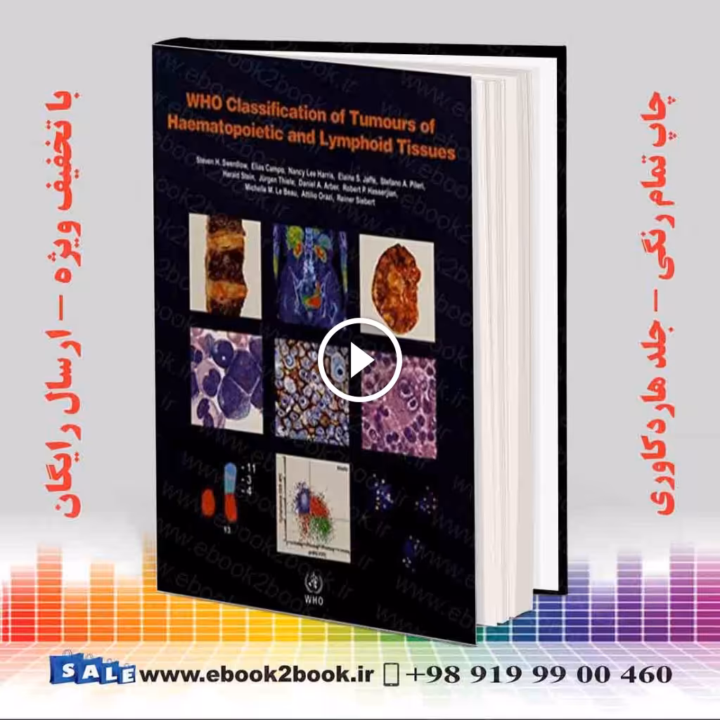 WHO Classification of Tumours of Haematopoietic and Lymphoid Tissues