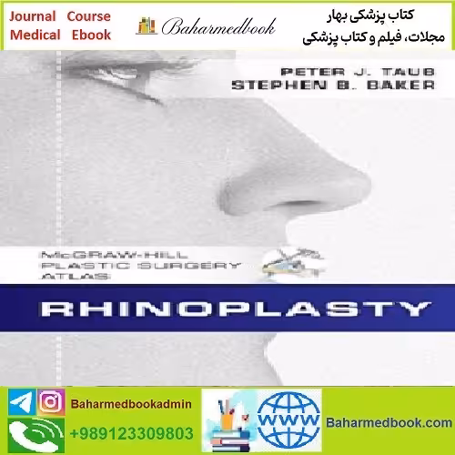 Rhinoplasty TRUE PDF price 1€
