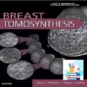 Breast Tomosynthesis TRUE PDF price 1€