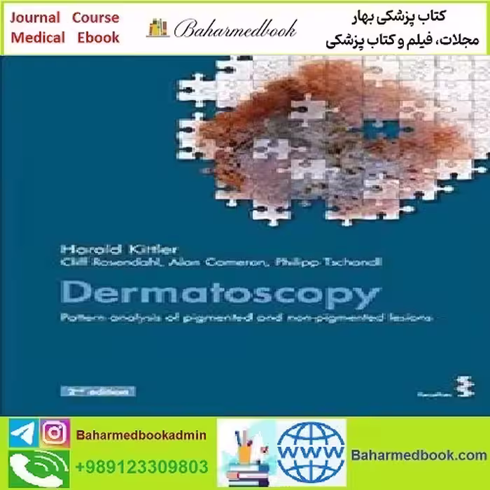 Dermatoscopy Pattern analysis of pigmented and non pigmented
