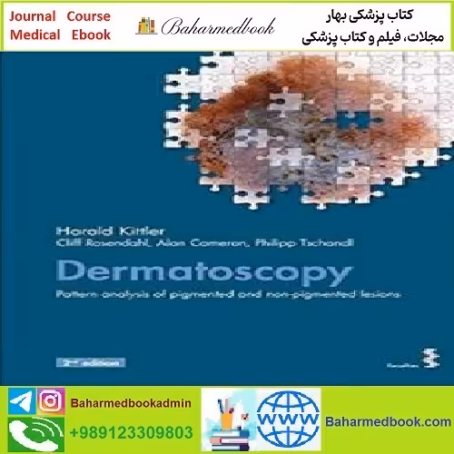 Dermatoscopy Pattern analysis of pigmented and non pigmented