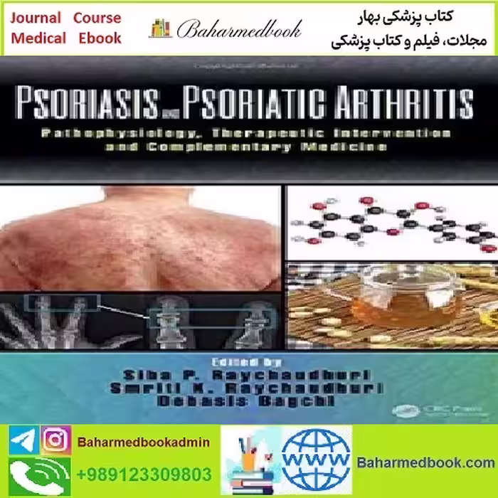 Psoriasis and Psoriatic Arthritis Pathophysiology Therapeutic Inte