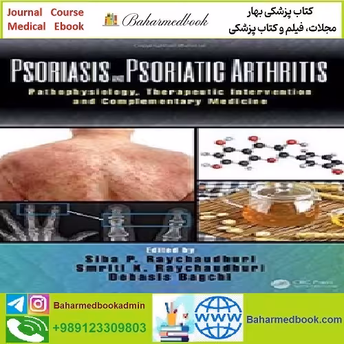 Psoriasis and Psoriatic Arthritis Pathophysiology Therapeutic Inte