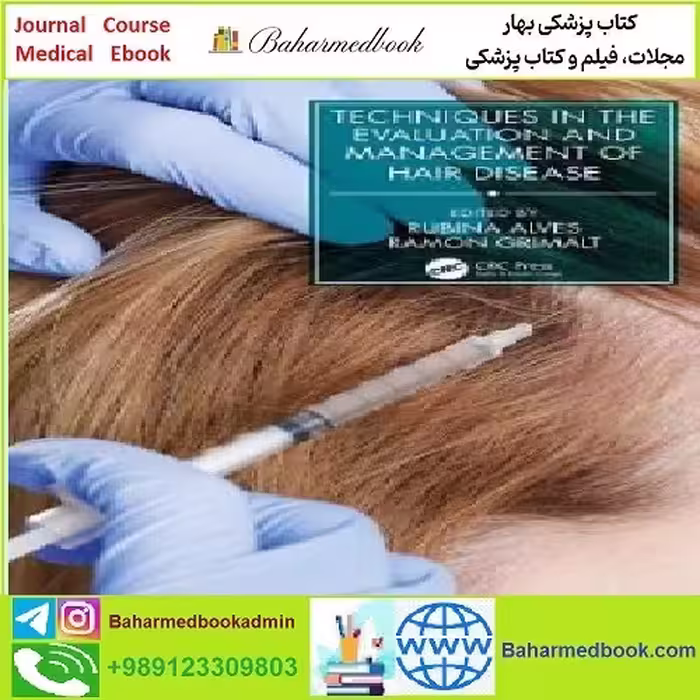 Techniques in the Evaluation and Management of Hair Diseases