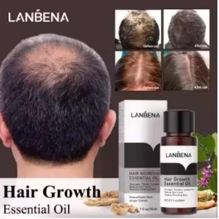 تقویت کننده مو اصل اورجینال تقویت موها لوسیون محلول ریش پرپشت کننده بلند کننده ضخیم کننده ضد موخوره احیا کننده موها