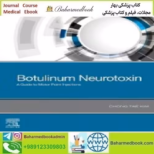 Botulinum Neurotoxin A Guide to Motor Point Injections 202
