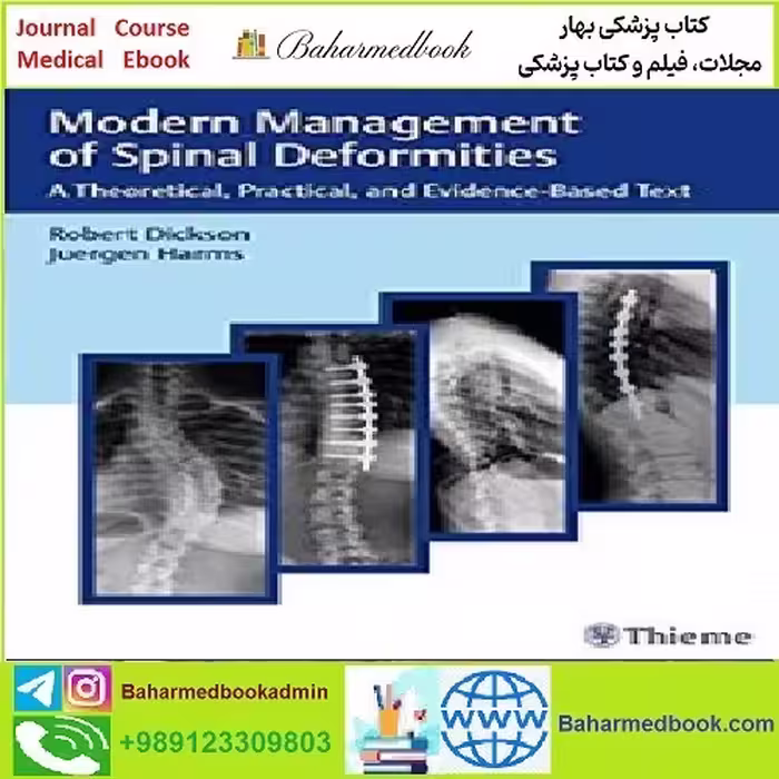 Modern Management of Spinal Deformities TRUE PDF price 1€ - کتاب پزشکی بهار
