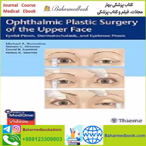 Ophthalmic Plastic Surgery of the Upper Face TRUE PDF price 1€