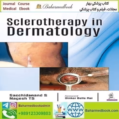 Sclerotherapy in Dermatology 2018 TRUE PDF دانلود کتاب الکترونیکی