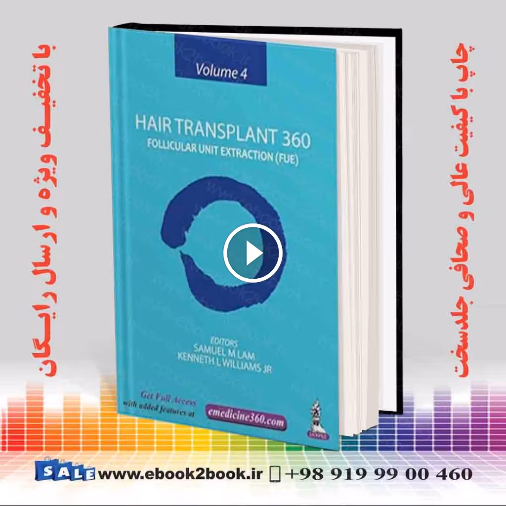 Hair Transplant 360: Follicular Unit Extraction (FUE)