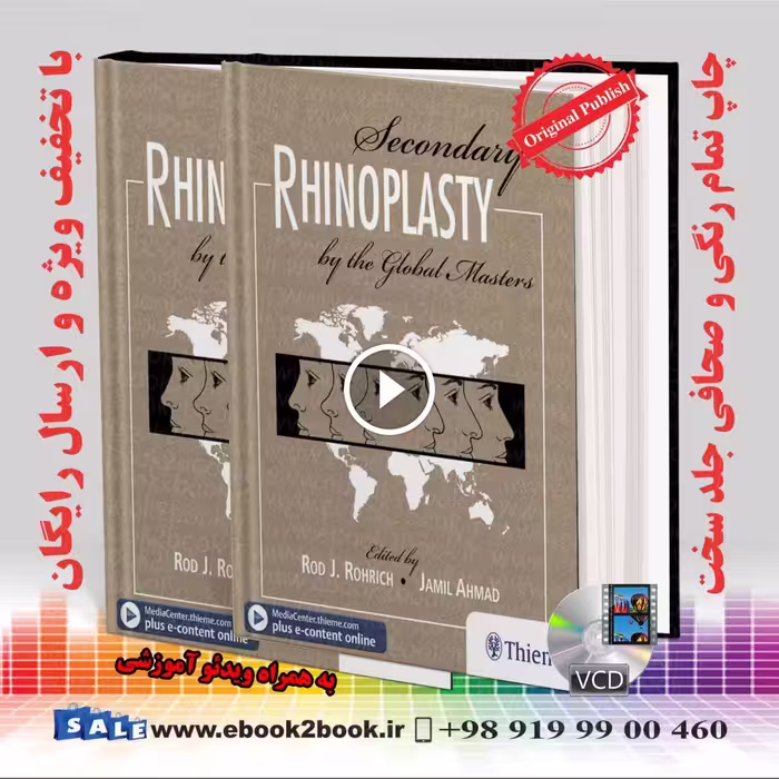 Secondary Rhinoplasty by the Global Masters