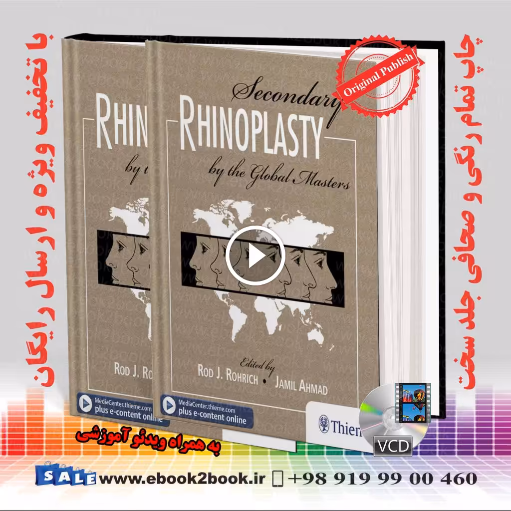 Secondary Rhinoplasty by the Global Masters