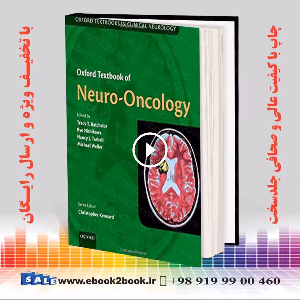 Oxford Textbook of Neuro-Oncology