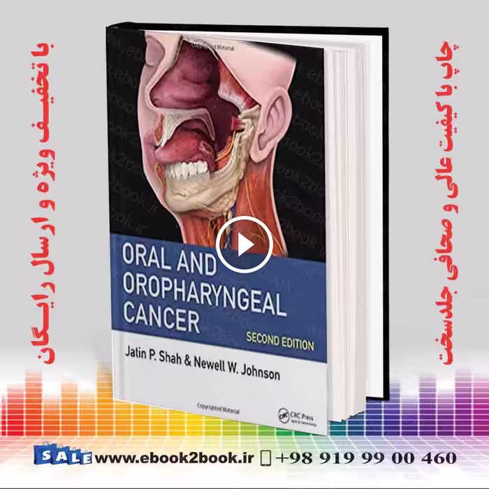 Oral and Oropharyngeal Cancer 2nd Edition