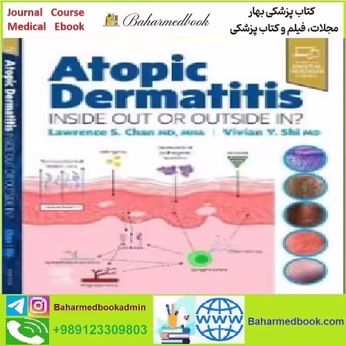 Atopic Dermatitis Inside Out or Outside In TRUE PDF price 1€ - کتاب پزشکی بهار