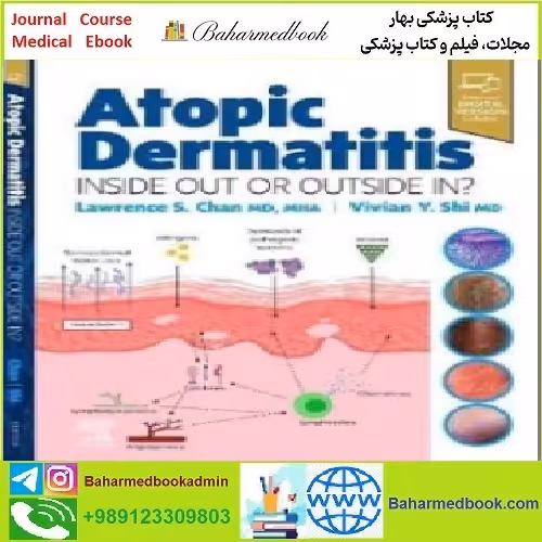 Atopic Dermatitis Inside Out or Outside In TRUE PDF price 1€ - کتاب پزشکی بهار
