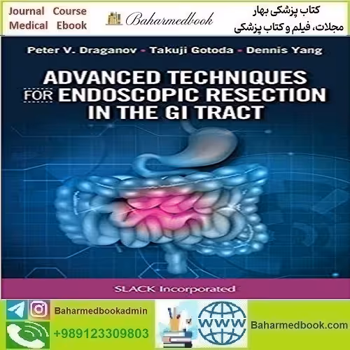Advanced Techniques for Endoscopic Resection in the GI Tract