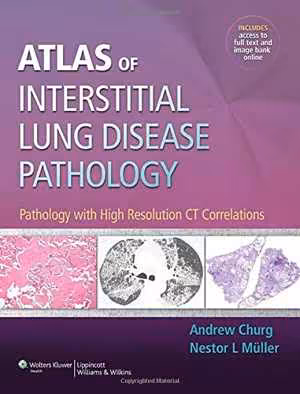 [PDF] دانلود کتاب Atlas Of Interstitial Lung Disease Pathology - Pathology With High Resolution Ct Correlations, 2013