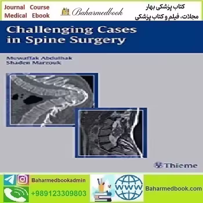 Challening Cases in Spine Surgery 2006 TRUE PDF price 1€ - کتاب پزشکی بهار
