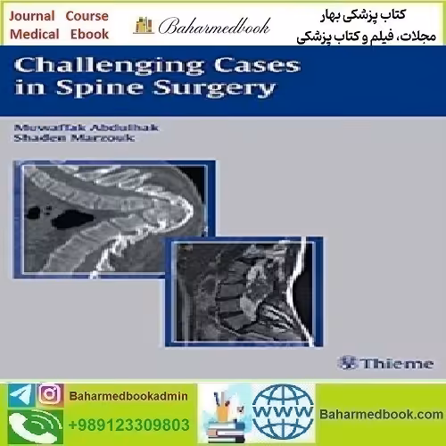 Challening Cases in Spine Surgery 2006 TRUE PDF price 1€ - کتاب پزشکی بهار