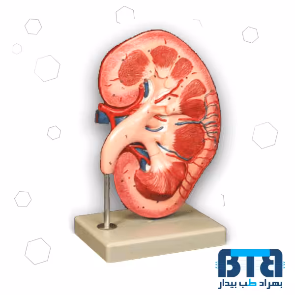 مولاژ کلیه ایستاده