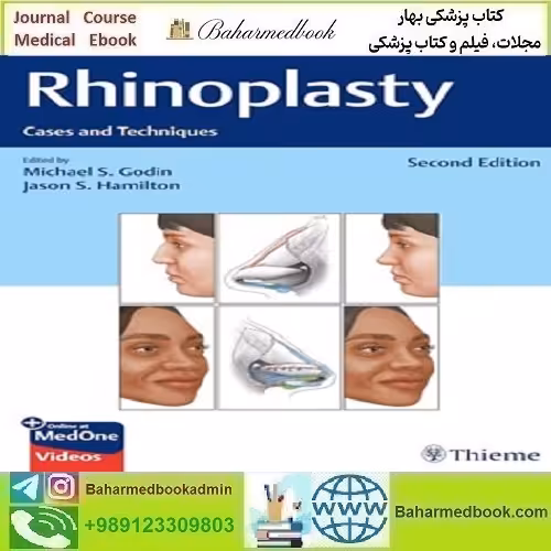 Rhinoplasty Cases and Techniques دانلود کتاب الکترونیکی بهمراه فیلم ها