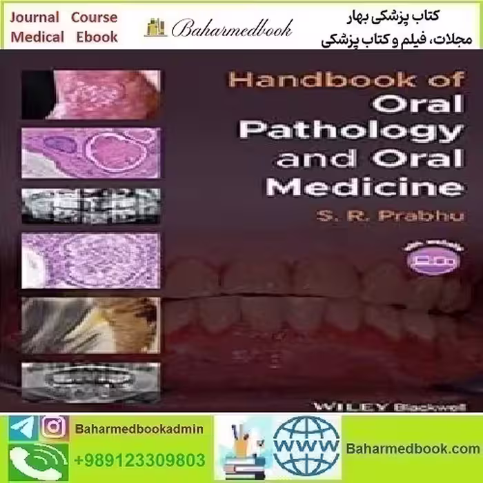Handbook of Oral Pathology and Oral Medicine 2022 TRU