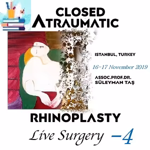 Closed Atraumatic Rhinoplasty Live Surgery 4 Price 20€ - کتاب پزشکی بهار