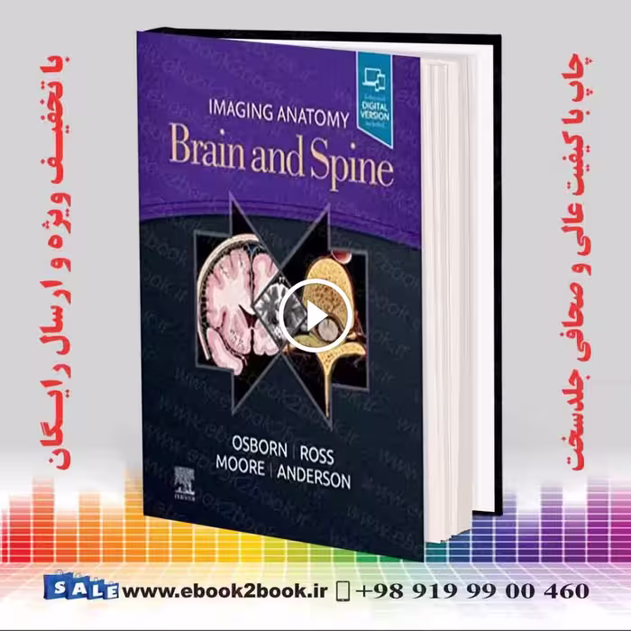 Imaging Anatomy Brain and Spine