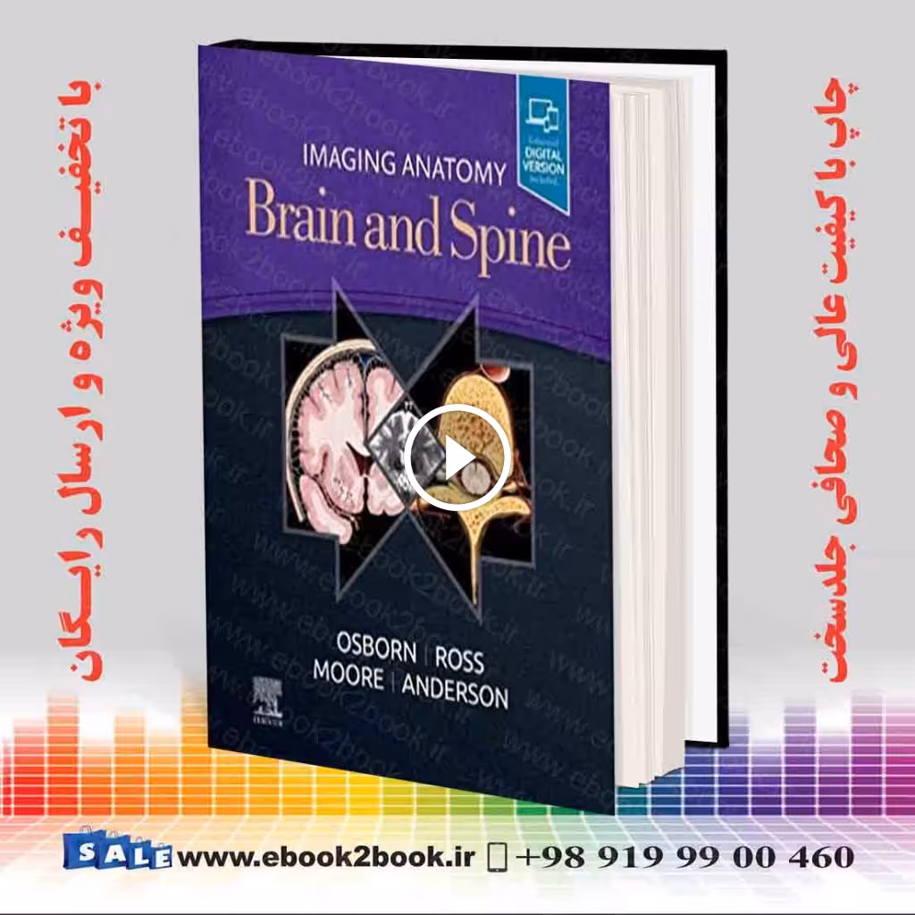 Imaging Anatomy Brain and Spine
