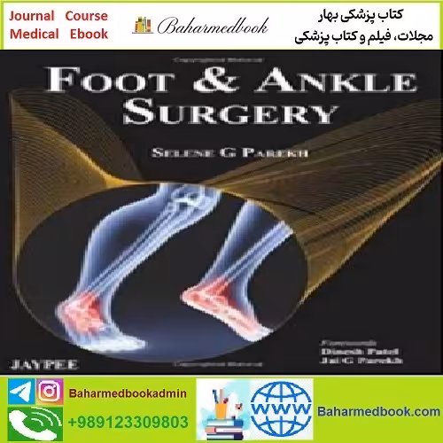 Foot and Ankle Surgery TRUE PDF price 1€ - کتاب پزشکی بهار