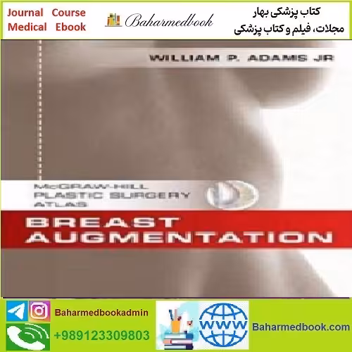 Breast Augmentation TRUE PDF price 1€ - کتاب پزشکی بهار