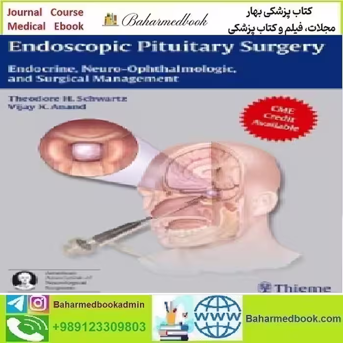 Endoscopic Pituitary Surgery Endocrine Neuro Ophthalmolog