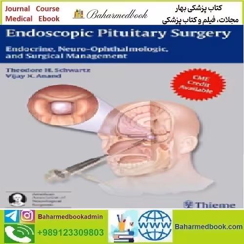 Endoscopic Pituitary Surgery Endocrine Neuro Ophthalmolog