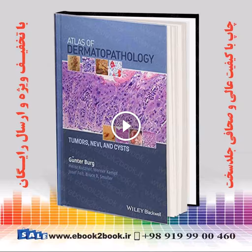 Atlas of Dermatopathology: Tumors Nevi and Cysts
