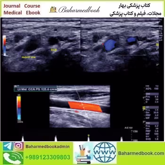 Clinical Approach to Vascular Ultrasound and RPVI Pre