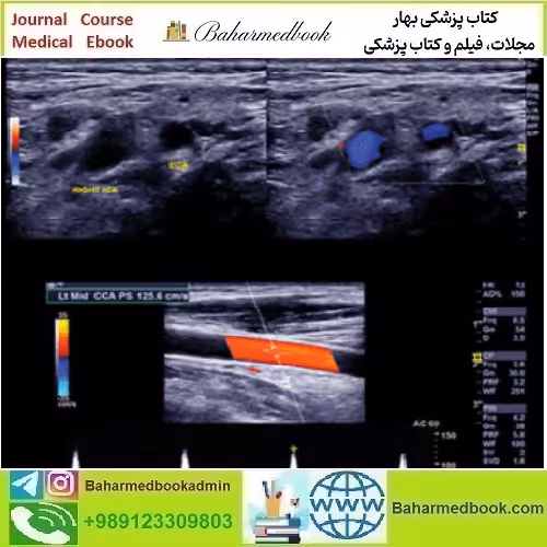 Clinical Approach to Vascular Ultrasound and RPVI Pre