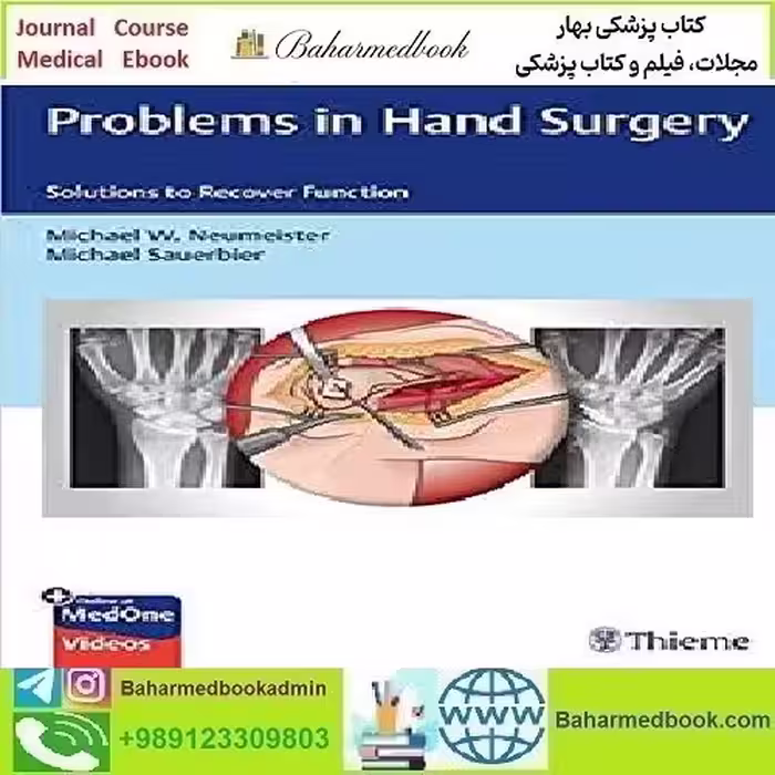 Problems in Hand Surgery Solutions to Recover Function Video