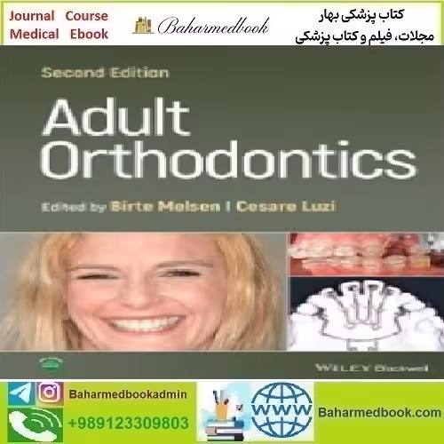 Adult Orthodontics 2022 TRUE PDF price 1€ - کتاب پزشکی بهار