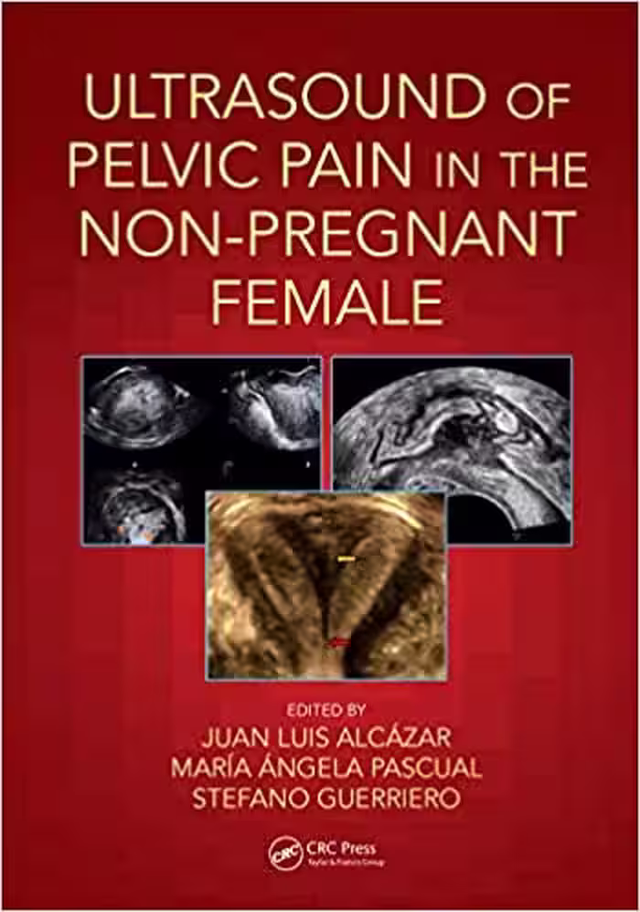 Ultrasound of Pelvic Pain in the Non-Pregnant Patient 2019 - کتاب پزشکی بهار