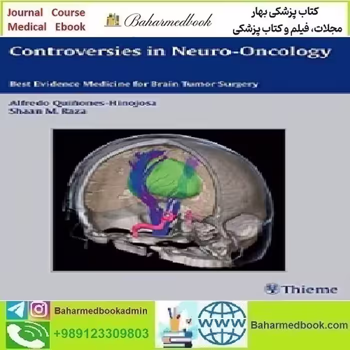 Controversies in Neuro Oncology Best Evidence Medicine for Brai