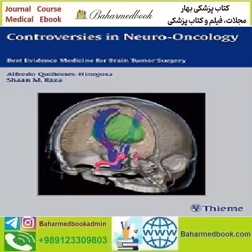 Controversies in Neuro Oncology Best Evidence Medicine for Brai