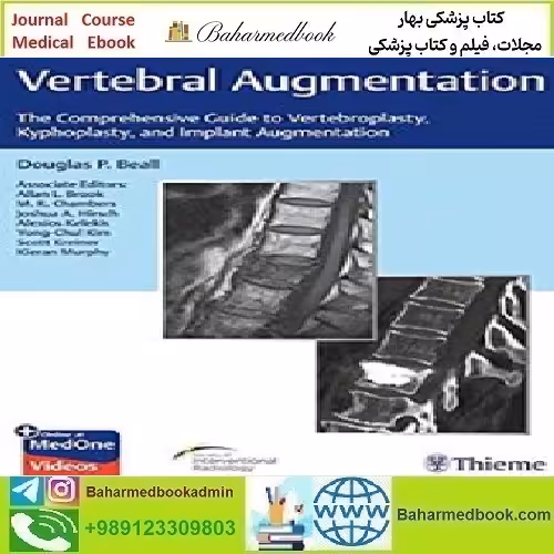 Vertebral Augmentation The Comprehensive Guide to Vertebropl