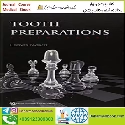 Tooth Preparations Science &amp; Art 2017 TRUE PDF price 1€ - کتاب پزشکی بهار